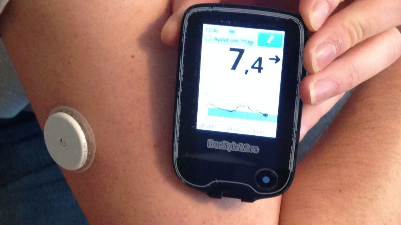 MIT ने बनाया ब्लड शुगर के लिए चमत्कारी इम्प्लांट, जो देगा इमरजेंसी इलाज